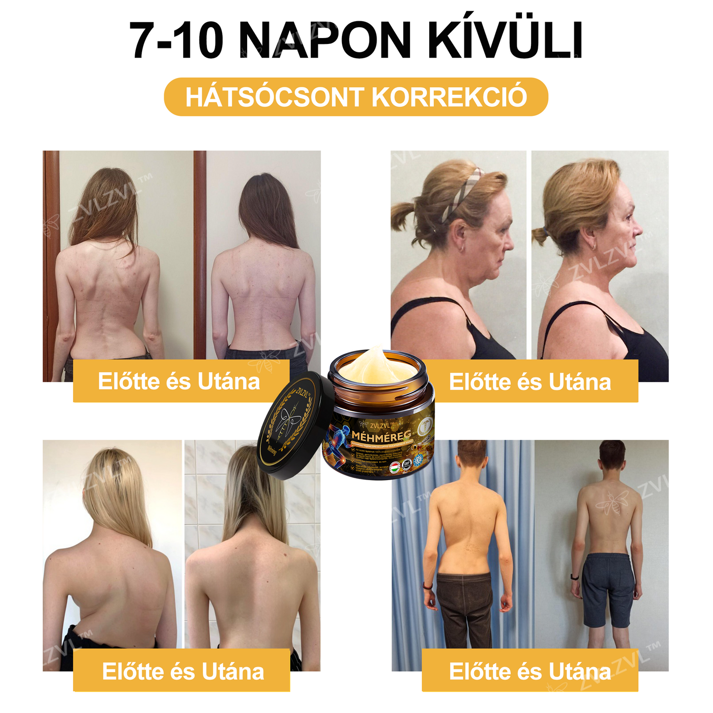 🎁 Már csak 5 doboz maradt! Élvezd a további 50% kedvezményt most! Maradj egészséges és energikus. Ha most nem ragadod meg ezt a lehetőséget, jövő évig kell várnod!