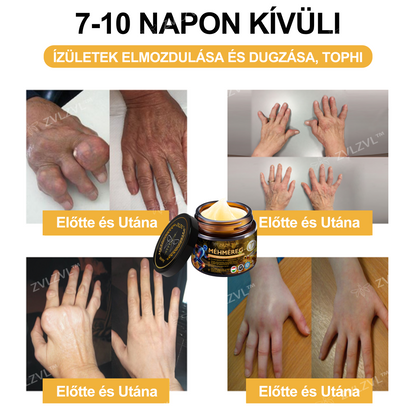 🎁 Már csak 5 doboz maradt! Élvezd a további 50% kedvezményt most! Maradj egészséges és energikus. Ha most nem ragadod meg ezt a lehetőséget, jövő évig kell várnod!