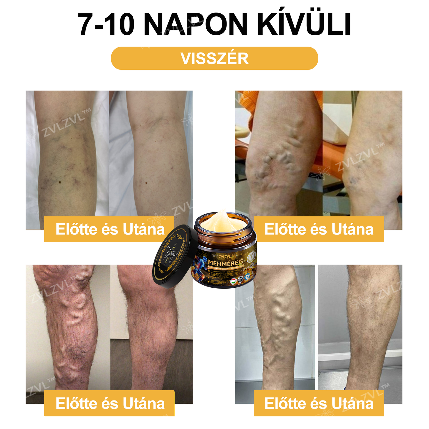 🎁 Már csak 5 doboz maradt! Élvezd a további 50% kedvezményt most! Maradj egészséges és energikus. Ha most nem ragadod meg ezt a lehetőséget, jövő évig kell várnod!