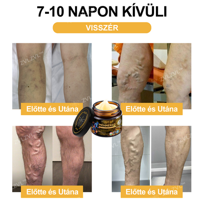 🎁 Már csak 5 doboz maradt! Élvezd a további 50% kedvezményt most! Maradj egészséges és energikus. Ha most nem ragadod meg ezt a lehetőséget, jövő évig kell várnod!