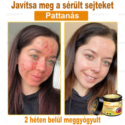 ΑΚΑPK®Méhméreg Átfogó Krém 🧑‍⚕️🧑‍⚕️ 🥇 Segít a bőrproblémák kezelésében, mint például: ráncok, hegek, pigmentációs foltok, striák, pattanások, pikkelysömör, ekcéma, bőrelváltozások, irritációk, gyulladások és egyéb bőrproblémák 🔥