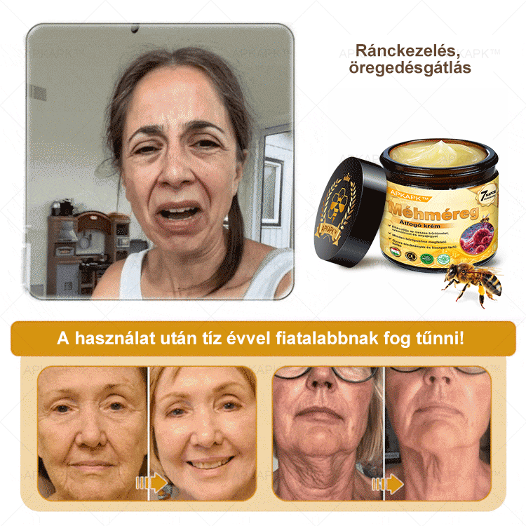 ΑΚΑPK®Méhméreg Átfogó Krém 🧑‍⚕️🧑‍⚕️ 🥇 Segít a bőrproblémák kezelésében, mint például: ráncok, hegek, pigmentációs foltok, striák, pattanások, pikkelysömör, ekcéma, bőrelváltozások, irritációk, gyulladások és egyéb bőrproblémák 🔥