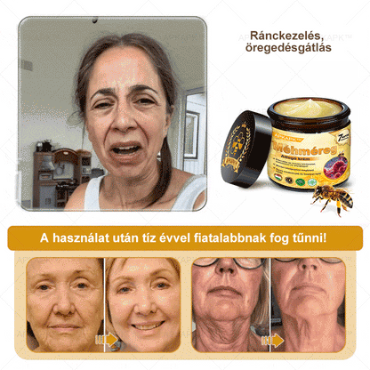 ΑΚΑPK®Méhméreg Átfogó Krém 🧑‍⚕️🧑‍⚕️ 🥇 Segít a bőrproblémák kezelésében, mint például: ráncok, hegek, pigmentációs foltok, striák, pattanások, pikkelysömör, ekcéma, bőrelváltozások, irritációk, gyulladások és egyéb bőrproblémák 🔥