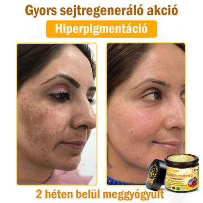 ΑΚΑPK®Méhméreg Átfogó Krém 🧑‍⚕️🧑‍⚕️ 🥇 Segít a bőrproblémák kezelésében, mint például: ráncok, hegek, pigmentációs foltok, striák, pattanások, pikkelysömör, ekcéma, bőrelváltozások, irritációk, gyulladások és egyéb bőrproblémák 🔥