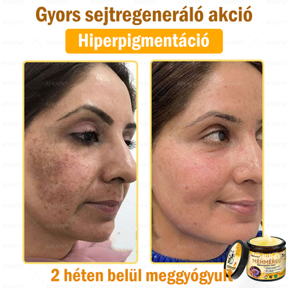 ✨💜💜APKAPK® 𝐌É𝐇𝐌É𝐑𝐄𝐆 Á𝐓𝐅𝐎𝐆Ó 𝐊𝐑É𝐌🥇𝐀 bőrnövedékek 𝐤𝐞𝐳𝐞𝐥é𝐬𝐞 𝐦𝐚𝐠á𝐛𝐚𝐧 𝐟𝐨𝐠𝐥𝐚𝐥𝐣𝐚: é𝐥𝐞𝐭𝐤𝐨𝐫𝐢 𝐟𝐨𝐥𝐭𝐨𝐤, 𝐡𝐞𝐠𝐞𝐤, 𝐬𝐳𝐞𝐦ö𝐥𝐜𝐬ö𝐤, 𝐛ö𝐫𝐧ö𝐯𝐞𝐝é𝐤𝐞𝐤, 𝐭á𝐥𝐲𝐨𝐠𝐨𝐤, 𝐩𝐚𝐭𝐭𝐚𝐧á𝐬𝐨𝐤, 𝐞𝐤𝐜é𝐦𝐚, 𝐩𝐬𝐨𝐫𝐢𝐚𝐬𝐢𝐬, 𝐚𝐜𝐧𝐞 𝐢𝐧𝐯𝐞𝐫𝐬𝐚, 𝐫á𝐧𝐜𝐨𝐤, 𝐛ö𝐫ö𝐫𝐞𝐠𝐞𝐝é𝐬 é𝐬 𝐞𝐠𝐲é𝐛 𝐩𝐫𝐨𝐛𝐥é𝐦á𝐤🔥💜